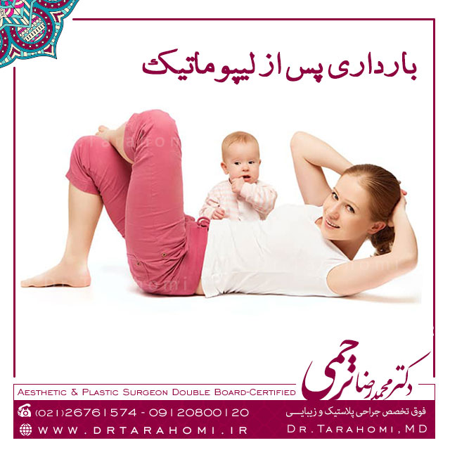 بارداری پس از لیپوماتیک