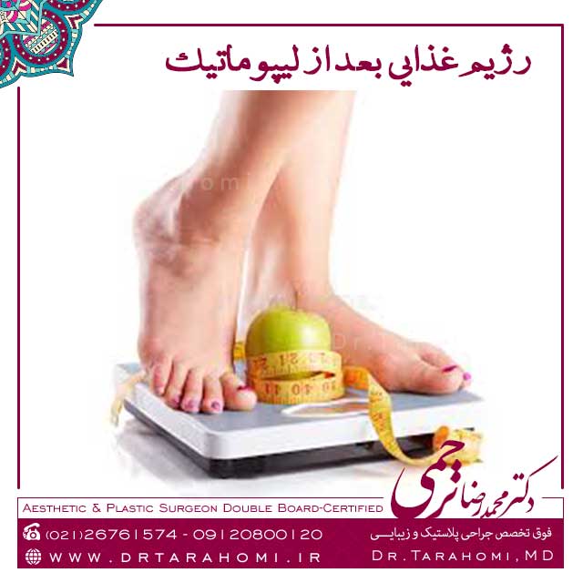 رژيم غذايي بعد از ليپوماتيک