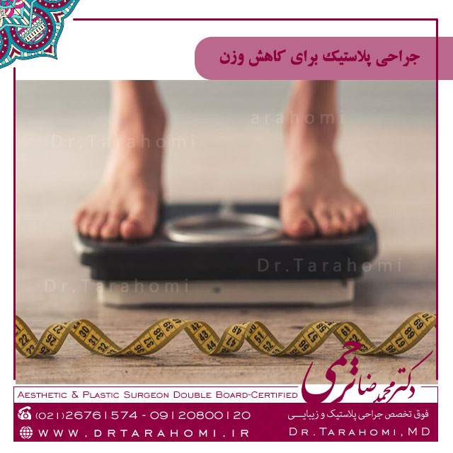 جراحی پلاستیک جهت کاهش وزن صحیح است؟