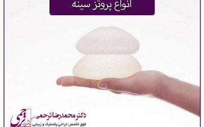 انواع پروتز سینه و بهترین نوع آن