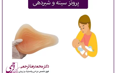 پروتز سینه و شیردهی