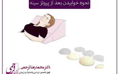 نحوه خوابیدن بعد از پروتز سینه