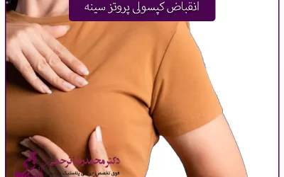 انقباض کپسولی پروتز سینه