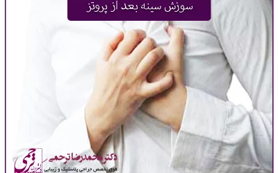 علت سوزش سینه بعد از پروتز