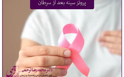 پروتز سینه بعد از سرطان